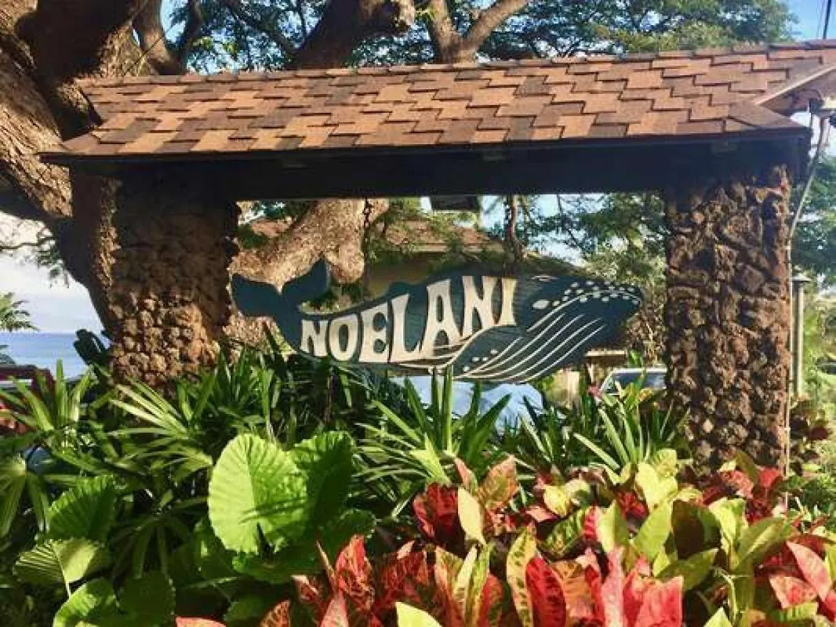 Noelani 101 Villa Kahana